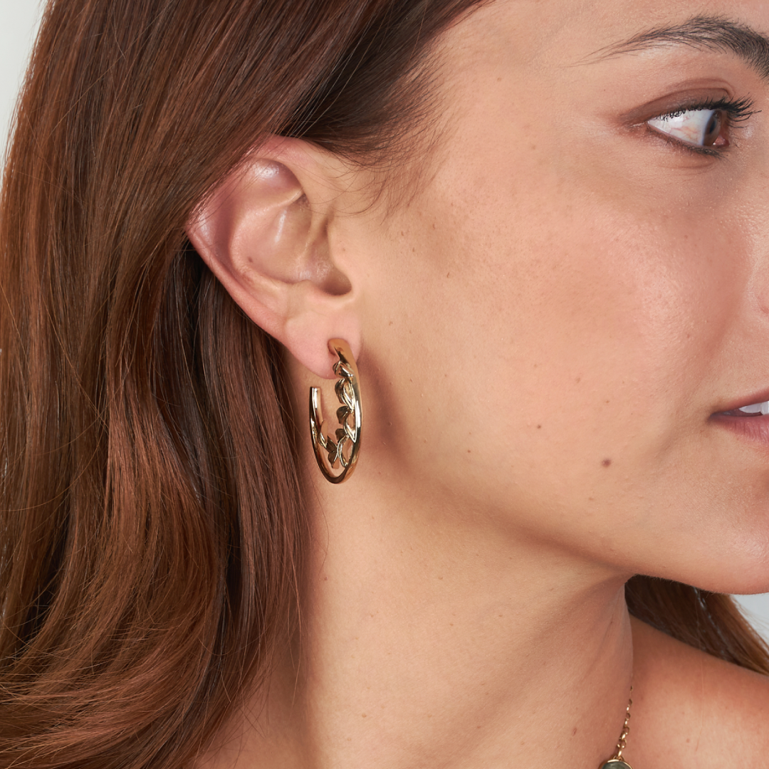Aretes Essen